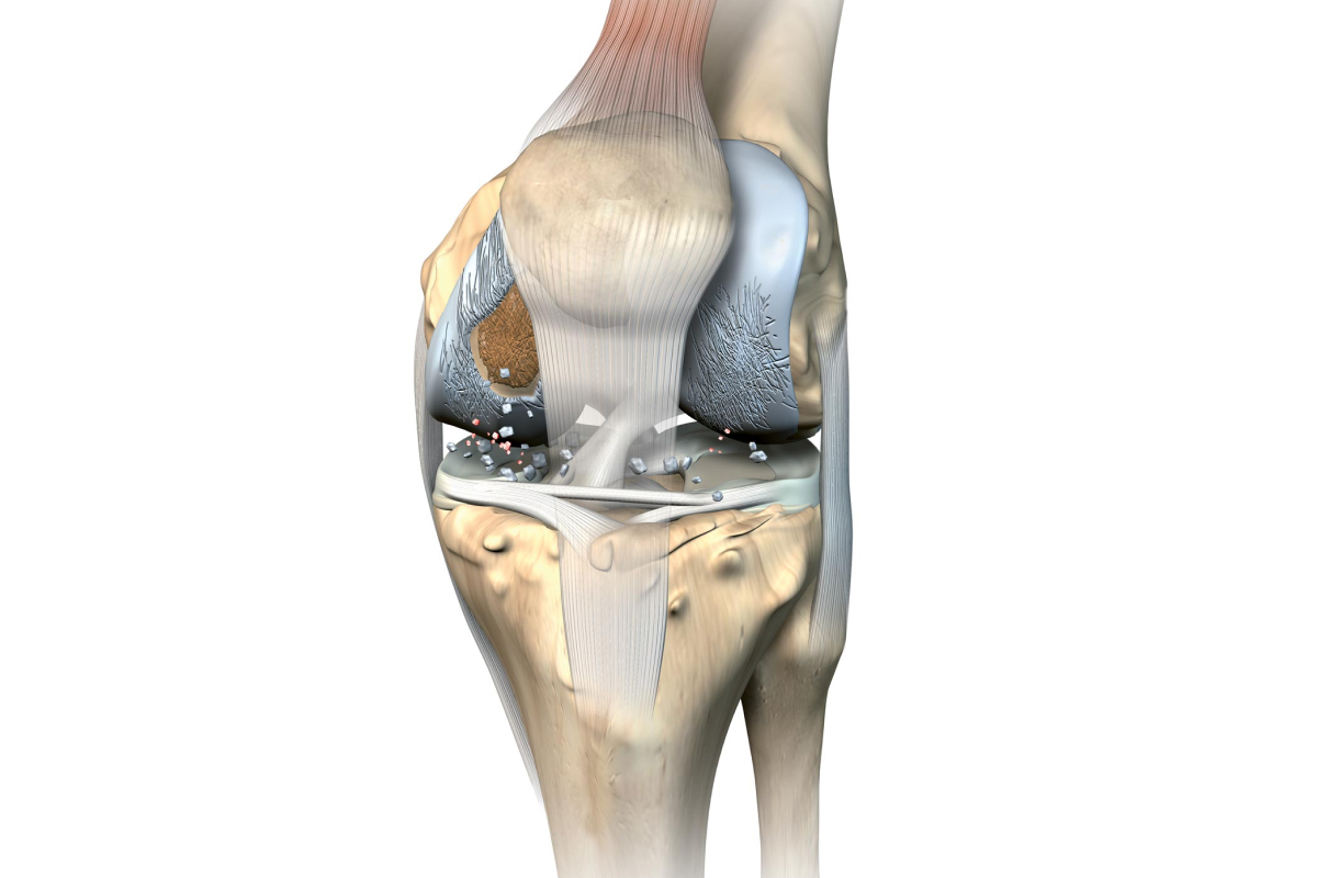 Anatomisches Bild von einem Knie 